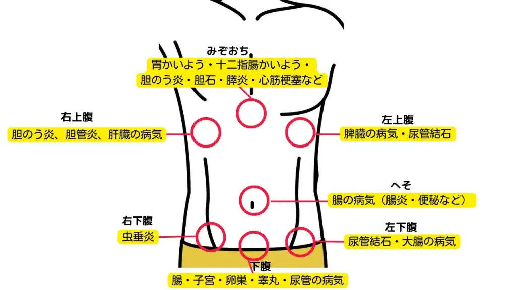 右下腹部痛の治療